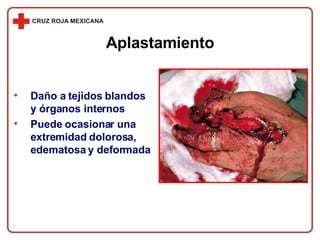 Aplastamiento Daño a tejidos blandos y órganos internos Puede ocasionar una extremidad dolorosa, edematosa y deformada 