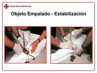 Objeto Empalado - Estabilización 