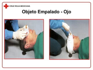 Objeto Empalado - Ojo 