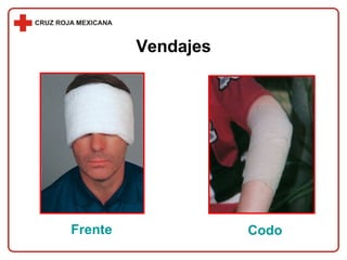 Frente Codo Vendajes 
