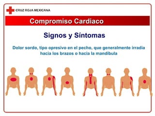 Compromiso Cardiaco Signos y Síntomas Dolor sordo, tipo opresivo en el pecho, que generalmente irradia hacia los brazos o hacia la mandíbula 