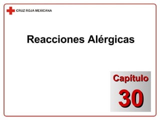 Reacciones Alérgicas Capítulo 30 
