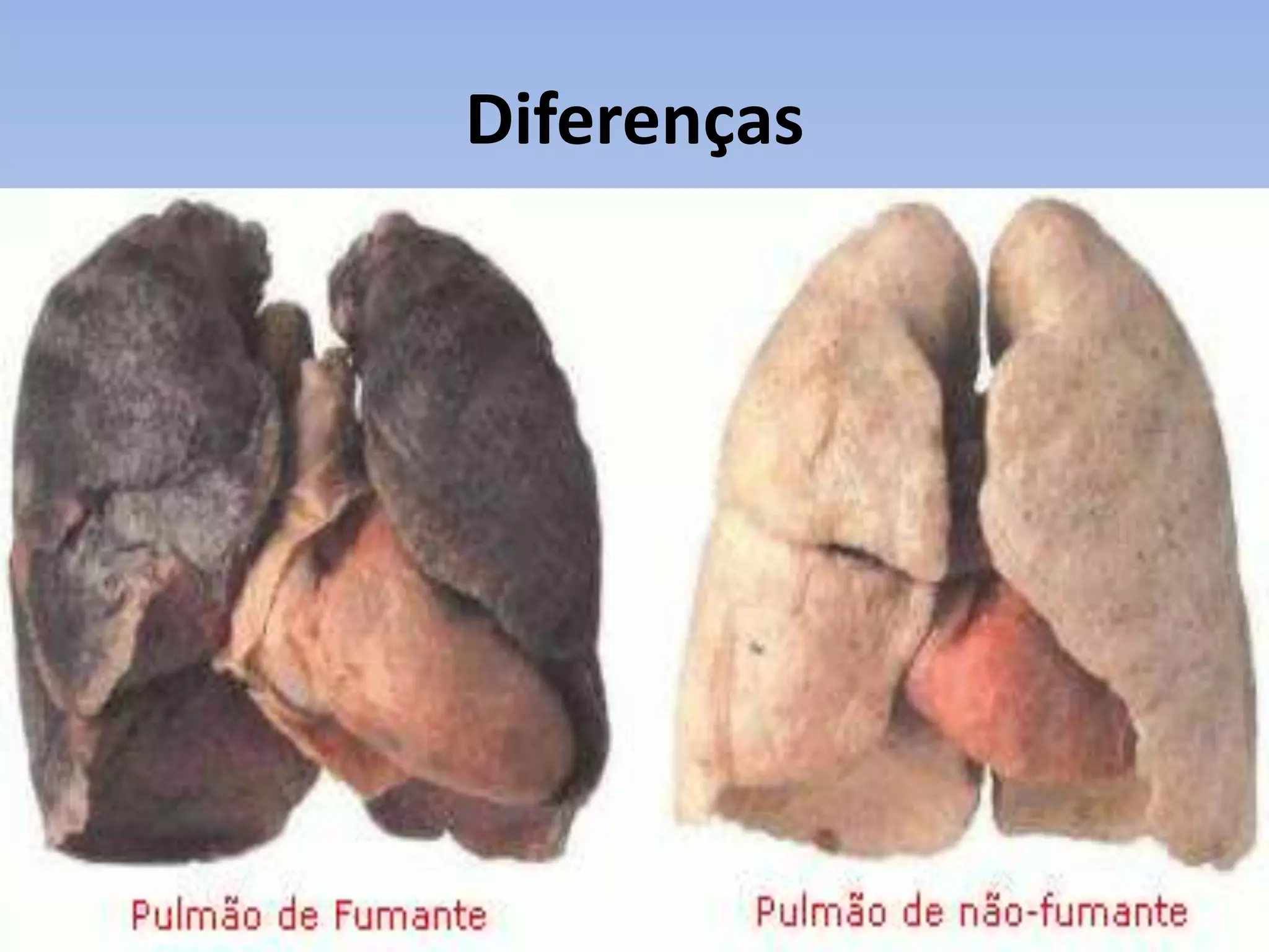 Diferenças
 
