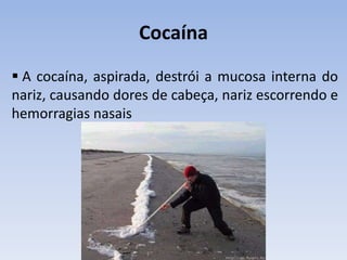 Cocaína
 A cocaína, aspirada, destrói a mucosa interna do
nariz, causando dores de cabeça, nariz escorrendo e
hemorragias nasais
 
