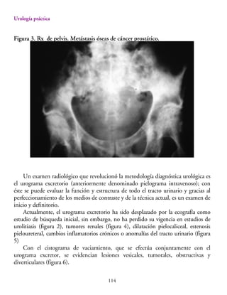 diagnostico radiológico en Urologia