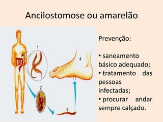Ancilostomose ou amarelão

                Prevenção:

                • saneamento
                básico adequado;
                • tratamento das
                pessoas
                infectadas;
                • procurar andar
                sempre calçado.
 