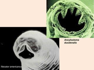 Ancylostoma
                     duodenalis




Necator americanus
 