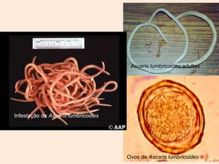 Ascaris lumbricoides adultas




Infestação de Ascaris lumbricoides




                                     Ovos de Ascaris lumbricoides
 
