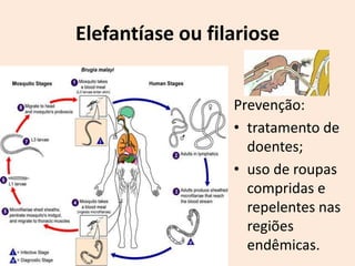 Elefantíase ou filariose


                  Prevenção:
                  • tratamento de
                    doentes;
                  • uso de roupas
                    compridas e
                    repelentes nas
                    regiões
                    endêmicas.
 