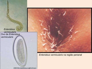 Enterobius
   vermicularis
Ovo de Enterobius
vermicularis




                    Enterobius vermicularis na região perianal
 