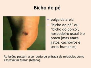 Bicho de pé

                              – pulga da areia
                              – “bicho do pé” ou
                                “bicho do porco”,
                                hospedeiro usual é o
                                porco (mas ataca
                                gatos, cachorros e
                                seres humanos)

As lesões passam a ser porta de entrada de micróbios como
Clostridium tetani (tétano).
 