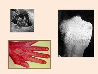 Capítulo 07   invertebrados II