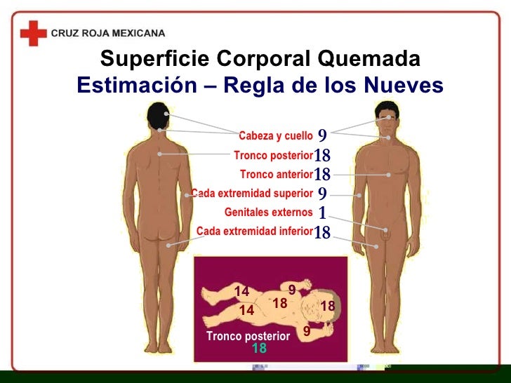 Capítulo 16 Emergencias Por Quemaduras
