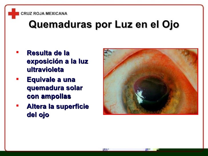 Sheynyy la osteocondrosis el vómito el tratamiento