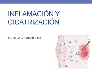 INFLAMACIÓN Y
CICATRIZACIÓN
Sánchez Cardel Alfonso
 