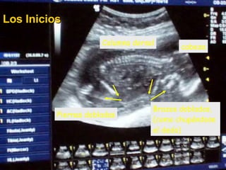cabeza Columna dorsal Piernas dobladas Brazos doblados,  (como chupándose  el dedo) Los Inicios 