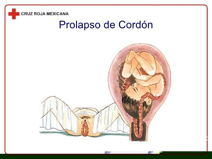 Capítulo 37 Emergencias Obstétricas Y Ginecológicas