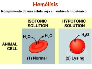 Hemólisis
Rompimiento de una célula roja en ambiente hipotónico.
 