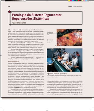 Patologia do Sistema Tegumentar
Repercussões Sistémicas
Queimaduras
O Sr. S é um homem de 23 anos de idade que tem dificuldade em ador-
mecer, à noite. Ficava muitasvezesa pé até tarde, aver televisão ou a ler,
até adormecer. Além disso, acende os cigarros uns nos outros. Uma noi-
te, tomou vários comprimidos para dormir. Infelizmente, adormeceu an-
tes de apagar o cigarro, provocando um incêndio. Como consequência,
ficou gravemente queimado, com queimaduras de espessura total e de
espessura parcial (figura Da). Levaram-no para o serviço de urgência e
acabou sendo transferido para uma unidade de queimados.
Durante o primeiro dia após o acidente, o seu estado era crítico,
por ter entrado em choque, situação que foi estabilizada com a admi-
nistração de grandes quantidades de líquidos intravenosos. O trata-
mento consistia ainda numa dieta rica em proteínas e em calorias.
Uma semana mais tarde, o tecido morto foi removido das quei-
maduras mais graves (figura Db) e foi feito um enxerto de pele. Apesar
do uso de antibióticos tópicos e dos pensos esterilizados, algumas das
queimaduras infectaram. Outra complicação foi o desenvolvimento de
uma trombose venosa numa perna.
Embora as queimaduras fossem dolorosas e o tratamento pro-
longado, o Sr. S teve uma recuperação total. Nunca mais fumou.
Fundamentação
Quando grandes áreas da pele ficam gravemente queimadas, produ-
zem-se efeitos sistémicos que podem ameaçar a vida. Um desses efei-
tos verifica-se nos capilares, que são pequenos vasos sanguíneos em
que os líquidos, gases, nutrientes e produtos de eliminação são nor-
malmente trocados entre o sangue e os tecidos. No espaço de minutos
após uma queimadura grave, os capilares ficam mais permeáveis no
local da queimadura e em todo o corpo. Por isso se perdem líquidos e
electrólitos (ver o capítulo 2) na região queimada e para os espaços
tecidulares. A perda de líquidos diminui o volume de sangue, o que
diminui a capacidade do coração para o bombear. A consequente di-
minuição do aporte de oxigénio aos tecidos pode provocar lesão
tecidular, choque ou mesmo a morte. O tratamento consiste na admi-
nistração intravenosa de líquidos, a um ritmo mais rápido do que o da
sua saída dos capilares. Embora isto possa reverter o choque e evitar a
morte, os líquidos continuam a escorrer para os espaços tecidulares
causando um edema (inchaço dos tecidos) acentuado.
Caracteristicamente, 24 horas depois a permeabilidade capilar re-
gressa ao normal e a quantidade de líquidos intravenosos administra-
dos pode ser muito reduzida. A razão pela qual uma queimadura desen-
cadeiaasalteraçõesdapermeabilidadecapilarnãoestábemesclarecida.
Está claro que, após uma queimadura, ocorrem alterações imunológicas
e metabólicas que não afectam apenas os capilares, mas também o res-
to do organismo. Por exemplo, os mediadores da inflamação (ver o
capítulo 4), libertados em resposta à lesão dos tecidos, contribuem para
produzir alterações da permeabilidade capilar em todo o corpo.
Substâncias libertadas pela queimadura também podem ter um
papel no funcionamento anormal das células. A queimadura leva a um
estado hipermetabólico quase imediato, que persiste até ao seu en-
cerramento. A reprogramação do centro cerebral de regulação térmica
Queimadura
de espessura
parcial
Queimadura
de espessura
total
Figura D Vítima de Queimadura
(a) Queimaduras de espessura parcial e de espessura total. (b) Vítima numa
unidade de queimados.
(a)
(b)
166 Parte 2 Suporte e Movimento
 
