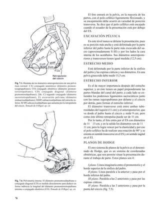El feto entrará en la pelvis, en la mayoría de los
partos, con el polo cefálico ligeramente flexionado, y
su encajamiento debe ocurrir en variedad de posición
transversa. Se dice que el polo cefálico está encajado
cuando el ecuador de la presentación está por debajo
del ES.

EXCAVACIÓN PÉLVICA
En este nivel nunca se detiene la presentación, pues
es su porción más ancha y está delimitada por la parte
inferior del pubis hasta la parte más excavada del sacro (aproximadamente S III) y por los lados la cara
interna de los acetábulos. Sus diámetros anteroposteriores y transversos tienen igual medida (12,5 cm).

ESTRECHO MEDIO
Está delimitado por la parte inferior de la sínfisis
del pubis y las espinas ciáticas y sus diámetros. En una
pelvis ginecoide debe medir 11,5 cm.

ESTRECHO INFERIOR
Fig. 7.3. Medidas de los diámetros anteroposteriores de una pelvis
ósea normal: CA) conjugado anatómico (diámetro promontosuprapubiano); CO) conjugado obstétrico (diámetro promontorretropubiano); CD) conjugado diagonal (diámetro
promontosubpubiano); 2do. C) segundo conjugado (diámetro
sacrorretropubiano); E) excavación pelviana (diámetro
midsacrosubpubiano); SSSP) subsacrosubpubiano del estrecho inferior; SCSP) subcoccixsubpubiano que aumenta por la retropulsión
del cóccix. Tomado de O Rigol, op. cit.

Es el de mayor importancia después del estrecho
superior, y en éste tienen un papel preponderante las
partes blandas del canal del parto; a cada lado se extienden los poderosos ligamentos sacrociáticos junto
con las ramas isquiopubianas por delante y el cóccix
por detrás, para formar el estrecho inferior.
El diámetro transverso está entre ambas tuberosidades del isquión (11 cm) y el anteroposterior, que
va desde el pubis hasta el cóccix y mide 9 cm; pero
como éste último retropulsa puede ser de 11 cm.
Por lo tanto, el feto entra por el ES con diámetros
de 11 ´ 13 cm, y en la salida los diámetros son de 11 ´
11 cm; pero lo logra vencer por la elasticidad y por eso
el polo cefálico ha de realizar una rotación de 90° y se
orienta en sentido transverso en el ES y en sentido sagital
en el EI.

PLANOS DE HODGE
El otro sistema de planos de la pelvis es el denominado de Hodge, que es un sistema de coordenadas
obstétricas, que nos permite situar la presentación durante el trabajo de parto. Estos planos son 4:

Fig. 7.4. Pelvimetría interna. El diámetro promontosubpubiano o
conjugado diagonal (CD) es medido directamente para deducir en
forma indirecta la longitud del diámetro promontorretropubiano
mínimo o conjugado obstétrico (CO). Tomado de O Rigol, op. cit.

76

I plano. Línea imaginaria entre el promontorio y el
borde superior de la sínfisis del pubis.
II plano. Línea paralela a la anterior y pasa por el
borde inferior del pubis.
III plano. Paralela a las 2 anteriores y pasa por las
espinas ciáticas.
IV plano. Paralela a las 3 anteriores y pasa por la
punta del cóccix (fig. 7.5).

 