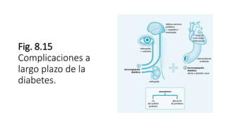 Fig. 8.15
Complicaciones a
largo plazo de la
diabetes.
 