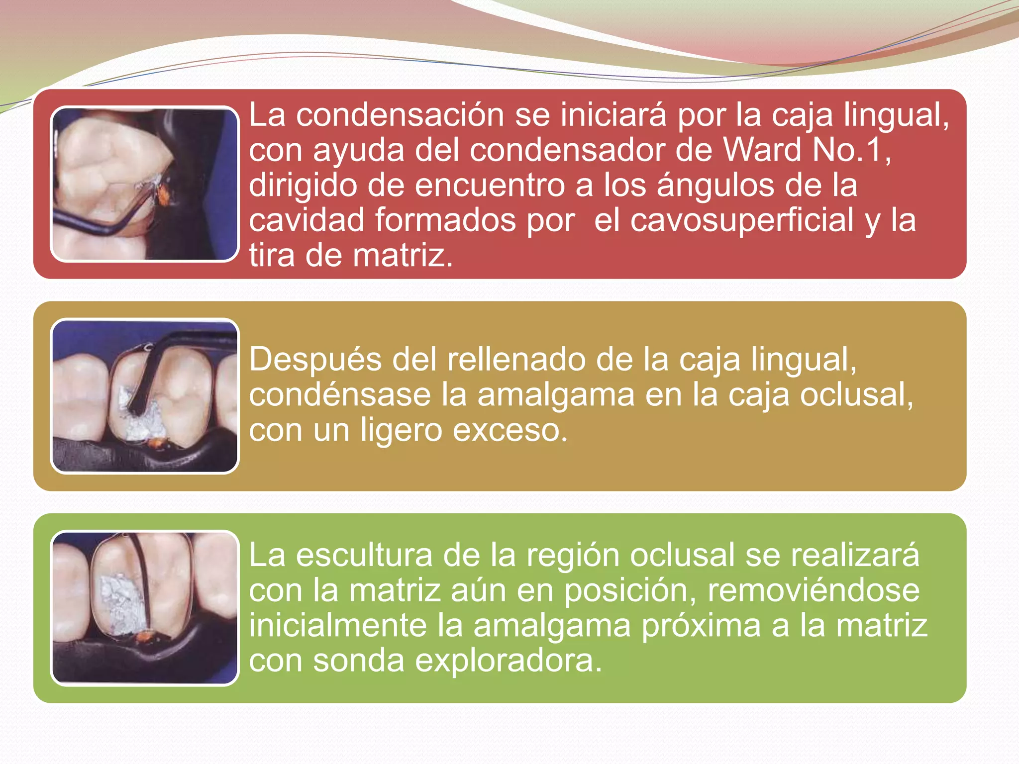 La condensación se iniciará por la caja lingual, 
con ayuda del condensador de Ward No.1, 
dirigido de encuentro a los ángulos de la 
cavidad formados por el cavosuperficial y la 
tira de matriz. 
Después del rellenado de la caja lingual, 
condénsase la amalgama en la caja oclusal, 
con un ligero exceso. 
La escultura de la región oclusal se realizará 
con la matriz aún en posición, removiéndose 
inicialmente la amalgama próxima a la matriz 
con sonda exploradora. 
 