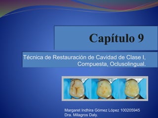 Técnica de Restauración de Cavidad de Clase I, 
Compuesta, Oclusolingual. 
Margaret Indhira Gómez López 100205945 
Dra. Milagros Daly. 
 