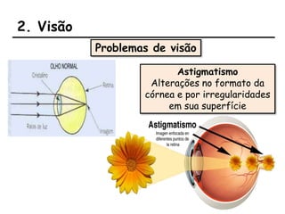 2. Visão
Problemas de visão
Astigmatismo
Alterações no formato da
córnea e por irregularidades
em sua superfície
 
