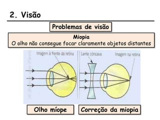 2. Visão
Problemas de visão
Miopia
O olho não consegue focar claramente objetos distantes
Olho míope Correção da miopia
 