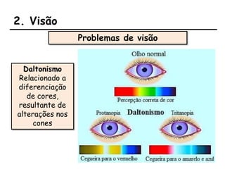 2. Visão
Daltonismo
Relacionado a
diferenciação
de cores,
resultante de
alterações nos
cones
Problemas de visão
 