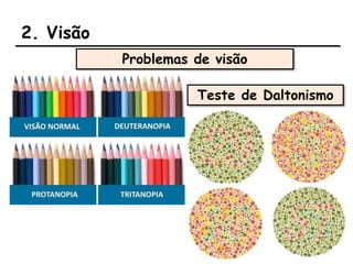 2. Visão
Problemas de visão
Teste de Daltonismo
 