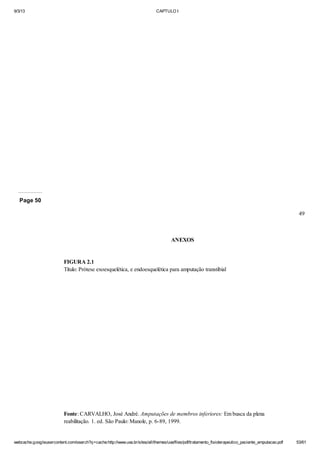 9/3/13

CAPTULO I

Page 50
49

ANEXOS

FIGURA 2.1
Título: Prótese exoesquelética, e endoesquelética para amputação transtibial

Fonte: CARVALHO, José André. Amputações de membros inferiores: Em busca da plena
reabilitação. 1. ed. São Paulo: Manole, p. 6-89, 1999.

webcache.googleusercontent.com/search?q=cache:http://www.uva.br/sites/all/themes/uva/files/pdf/tratamento_fisioterapeutico_paciente_amputacao.pdf

53/61

 