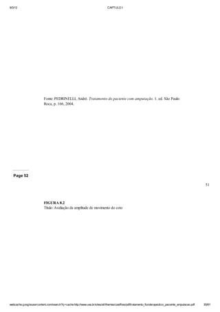 9/3/13

CAPTULO I

Fonte: PEDRINELLI, André. Tratamento do paciente com amputação. 1. ed. São Paulo:
Roca, p. 166, 2004.

Page 52
51

FIGURA 8.2
Título: Avaliação da amplitude de movimento do coto

webcache.googleusercontent.com/search?q=cache:http://www.uva.br/sites/all/themes/uva/files/pdf/tratamento_fisioterapeutico_paciente_amputacao.pdf

55/61

 