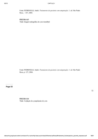 9/3/13

CAPTULO I

Fonte: PEDRINELLI, André. Tratamento do paciente com amputação. 1. ed. São Paulo:
Roca, ´. 167, 2004.

FIGURA 8.3
Titulo: Imagem radiográfica do coto transtibial

Fonte: PEDRINELLI, André. Tratamento do paciente com amputação. 1. ed. São Paulo:
Roca, p. 127, 2004.

Page 53
52

FIGURA 8.4
Titulo: Avaliação do comprimento do coto

webcache.googleusercontent.com/search?q=cache:http://www.uva.br/sites/all/themes/uva/files/pdf/tratamento_fisioterapeutico_paciente_amputacao.pdf

56/61

 