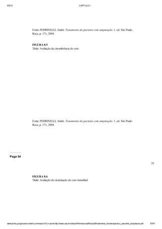 9/3/13

CAPTULO I

Fonte: PEDRINELLI, André. Tratamento do paciente com amputação. 1. ed. São Paulo:
Roca, p. 171, 2004.

FIGURA 8.5
Título: Avaliação da circunferência do coto

Fonte: PEDRINELLI, André. Tratamento do paciente com amputação. 1. ed. São Paulo:
Roca, p. 171, 2004.

Page 54
53

FIGURA 8.6
Titulo: Avaliação da cicatrização do coto transtibial

webcache.googleusercontent.com/search?q=cache:http://www.uva.br/sites/all/themes/uva/files/pdf/tratamento_fisioterapeutico_paciente_amputacao.pdf

57/61

 