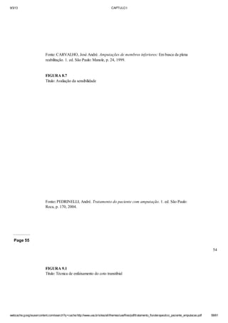 9/3/13

CAPTULO I

Fonte: CARVALHO, José André. Amputações de membros inferiores: Em busca da plena
reabilitação. 1. ed. São Paulo: Manole, p. 24, 1999.

FIGURA 8.7
Titulo: Avaliação da sensibilidade

Fonte: PEDRINELLI, André. Tratamento do paciente com amputação. 1. ed. São Paulo:
Roca, p. 170, 2004.

Page 55
54

FIGURA 9.1
Título: Técnica de enfaixamento do coto transtibial

webcache.googleusercontent.com/search?q=cache:http://www.uva.br/sites/all/themes/uva/files/pdf/tratamento_fisioterapeutico_paciente_amputacao.pdf

58/61

 