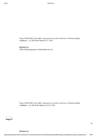 9/3/13

CAPTULO I

Fonte: CARVALHO, José André. Amputações de membros inferiores: Em busca da plena
reabilitação. 1. ed. São Paulo: Manole, p.57, 1999.

FIGURA 9.3
Título: Cinesioterapia para o fortalecimento do coto

Fonte: CARVALHO, José André. Amputações de membros inferiores: Em busca da plena
reabilitação. 1. ed. São Paulo: Manole, p.81-83, 1999.

Page 57
56

FIGURA 9.4
webcache.googleusercontent.com/search?q=cache:http://www.uva.br/sites/all/themes/uva/files/pdf/tratamento_fisioterapeutico_paciente_amputacao.pdf

60/61

 