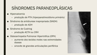 SÍNDROMES PARANEOPLÁSICAS
■ Hipercalcemia
– produção de PTH (hiperparatireoidismo primário)
■ Síndrome da antidiurese inapropriada (SIADH)
– produção de ADH
■ Síndrome de Cushing
– produção ACTH ou CRH
■ Osteoartropatia Pulmonar Hipertrófica (OPH)
– aumento dos tecidos moles nas extremidades
ósseas
– sinovite de grandes articulações periférica
 