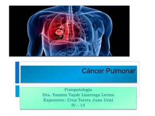Fisiopatologia
Dra. Yazmin Tayde Lizarraga Lerma
Exponente: Cruz Torres Juan Uriel
IV - 14
Cáncer Pulmonar
 