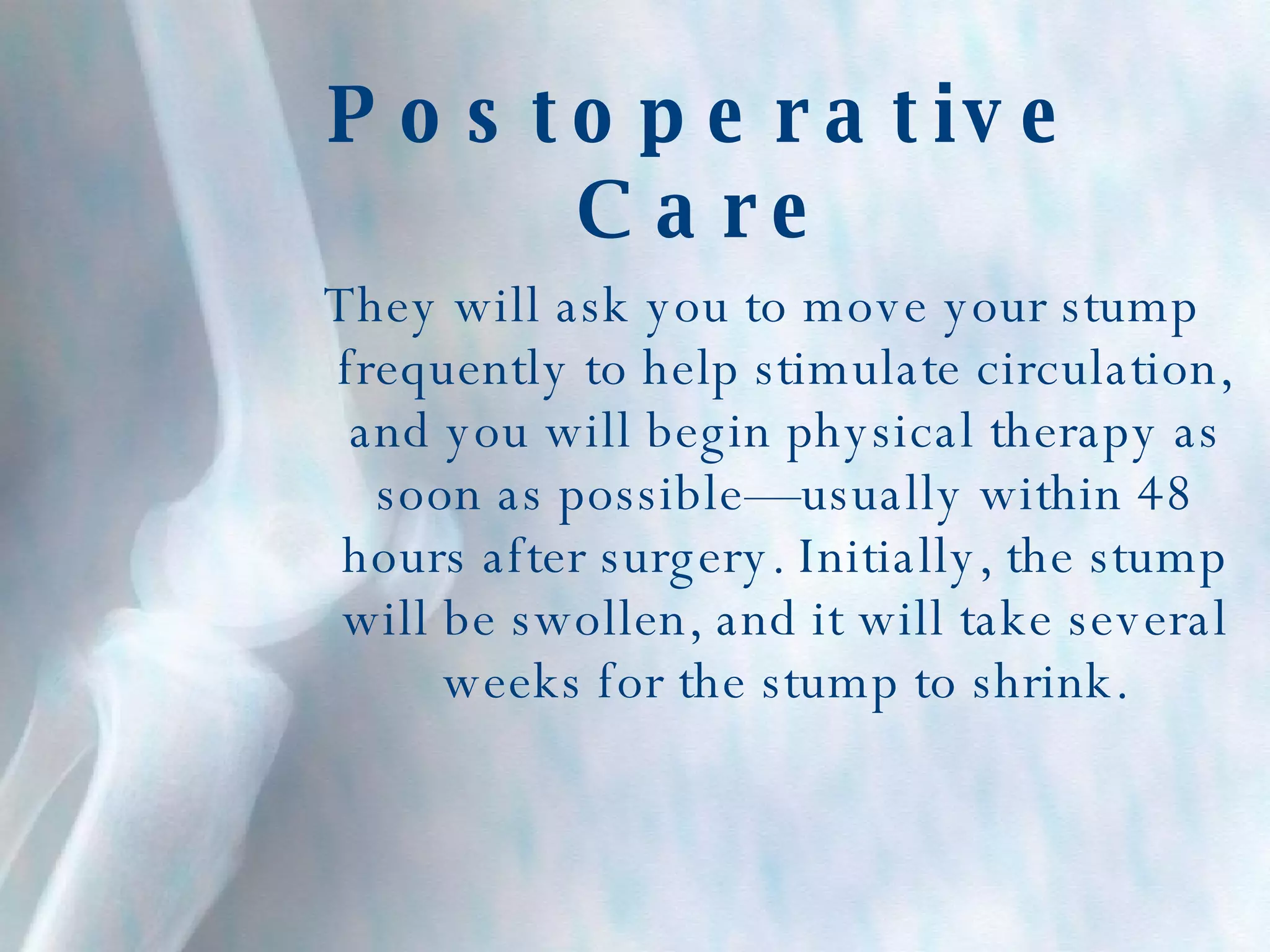 Postoperative Care They will ask you to move your stump frequently to help stimulate circulation, and you will begin physical therapy as soon as possible—usually within 48 hours after surgery. Initially, the stump will be swollen, and it will take several weeks for the stump to shrink. 