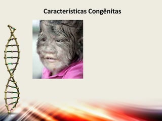 Características Congênitas

 