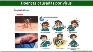 Doenças causadas por vírus
Principais Viroses
Dengue
 