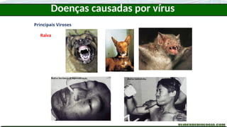 Doenças causadas por vírus
Principais Viroses
Raiva
 