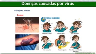 Doenças causadas por vírus
Principais Viroses
Dengue
 