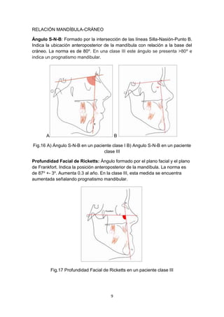 Caracteristicas clinicas y cefalometricas de clase iii | DOCX
