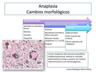Caracteristicas de las neoplasias benignas y malignas