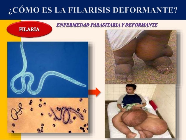 Botoks la persona del vídeo las lecciones