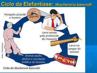Ciclo da Elefantíase: Wuchereria bancrofi
 