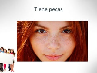 Tiene pecas
 