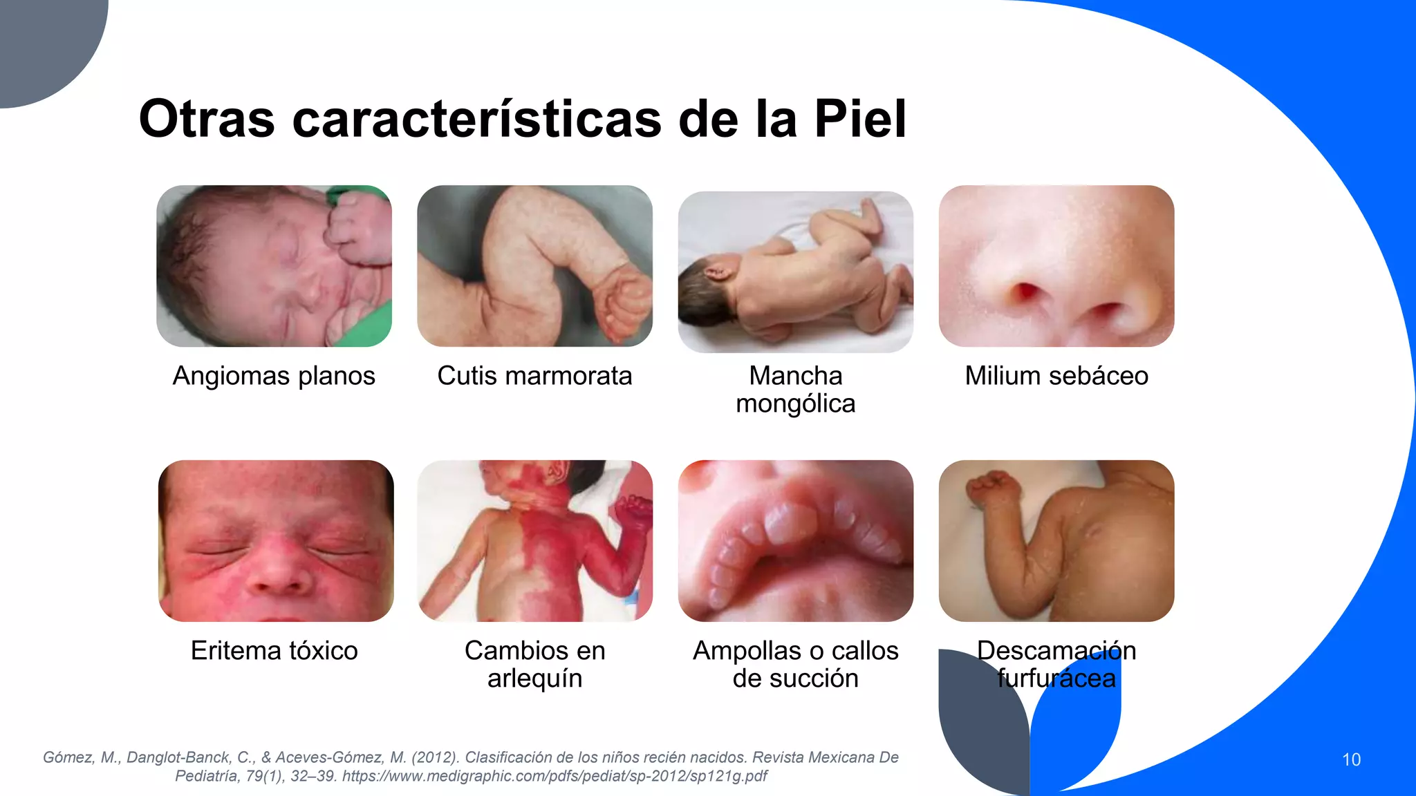 Características anatómicas y fisiológicas del Recién Nacido.pptx